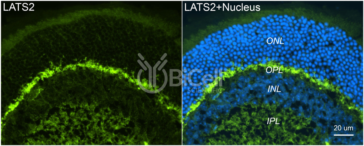 LATS2 (KPM) Antibody