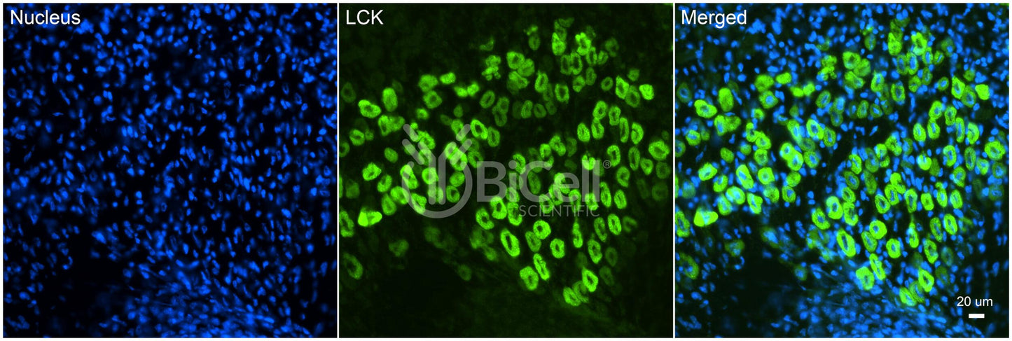 LCK (LSK) Antibody