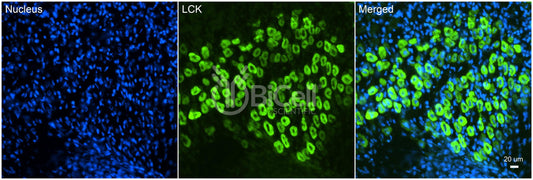 LCK (LSK) Antibody