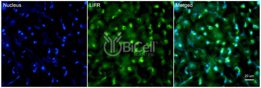 LIFR (CD118) Antibody - FFPE Validated