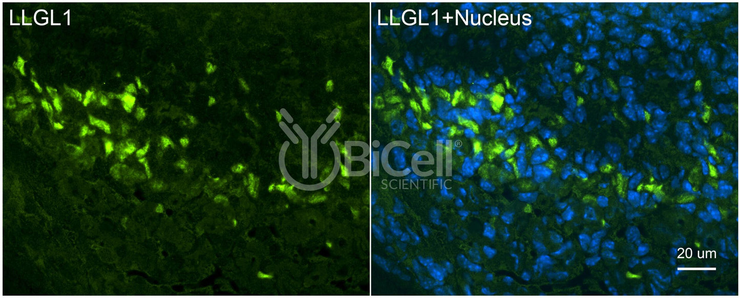 LLGL1 (LGL1) Antibody - FFPE Validated