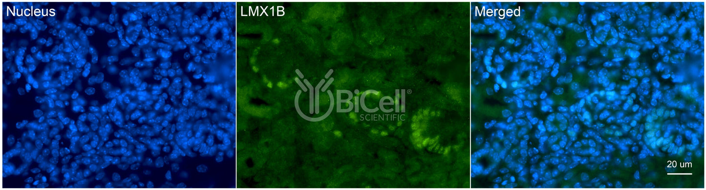 LMX1B Antibody - FFPE Validated