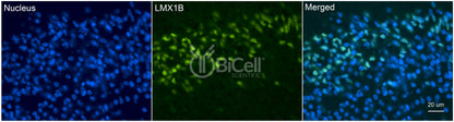 LMX1B Antibody - Western Blot Validated