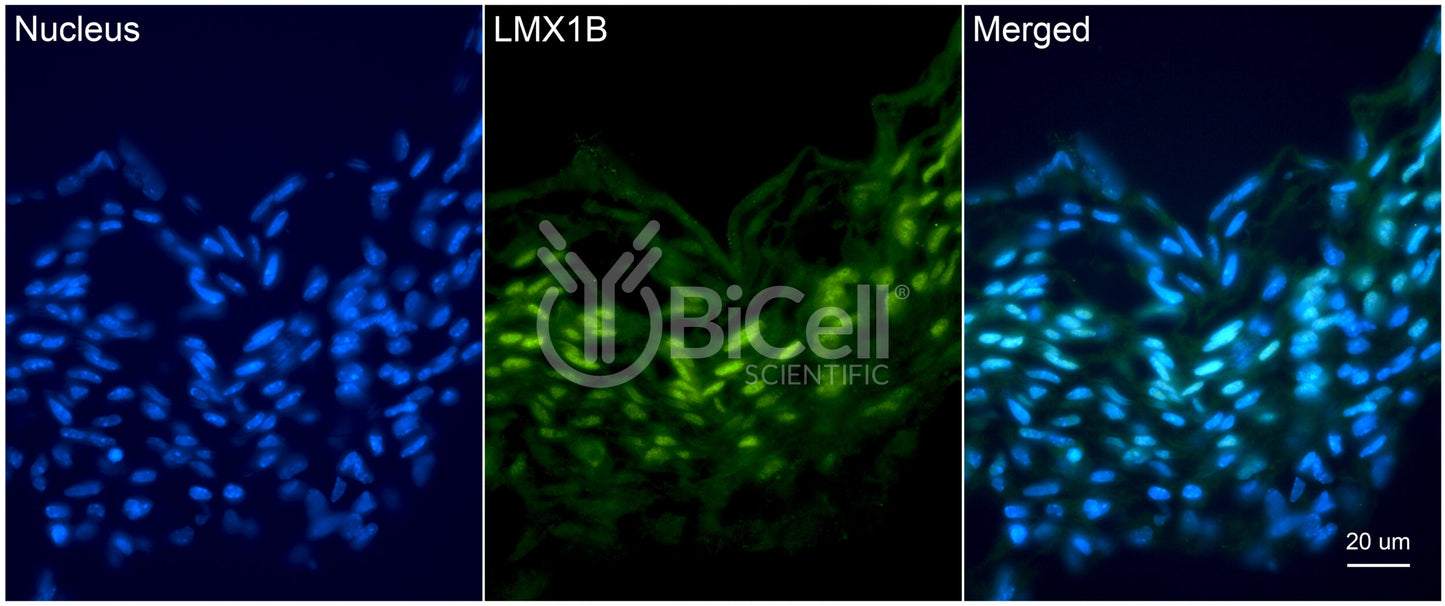LMX1B Antibody