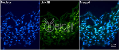LMX1B Antibody