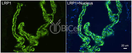 LRP1 (CD91) Antibody - Western Blot Validated