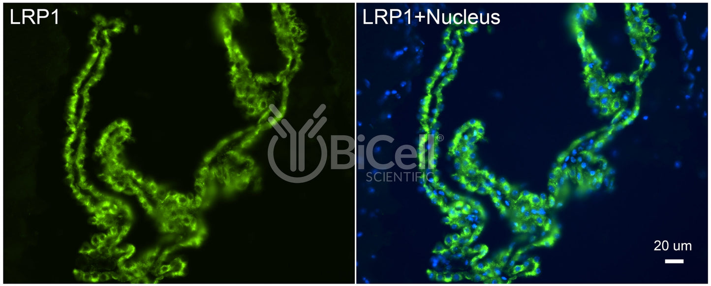 LRP1 (CD91) Antibody
