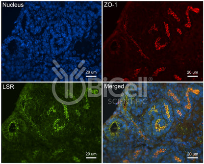 LSR (Angulin-1) Antibody - FFPE Validated