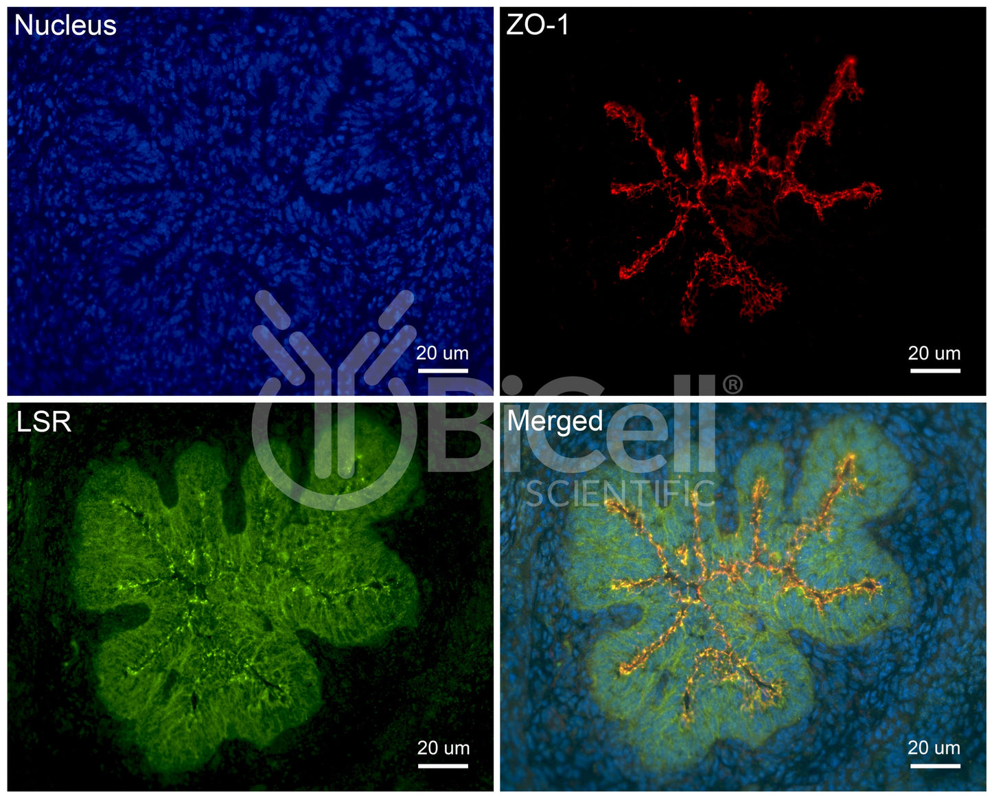 LSR (Angulin-1) Antibody - Western Blot Validated