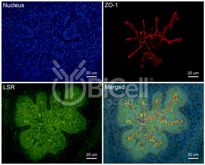 LSR (Angulin-1) Antibody - Western Blot Validated