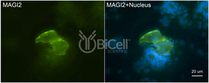 MAGI2 (AIP1 or NPHS15) Antibody - FFPE Validated