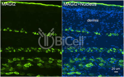 MAGI2 (AIP1 or NPHS15) Antibody - FFPE Validated