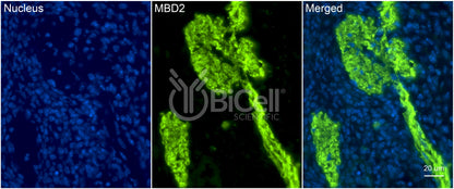 MBD2 (DMTase) Antibody