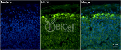 MBD2 (DMTase) Antibody - FFPE Validated