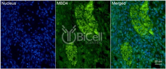 MBD4 (MED1) Antibody - FFPE Validated