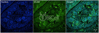 MCAM (CD146 or MUC18) Antibody - FFPE Validated