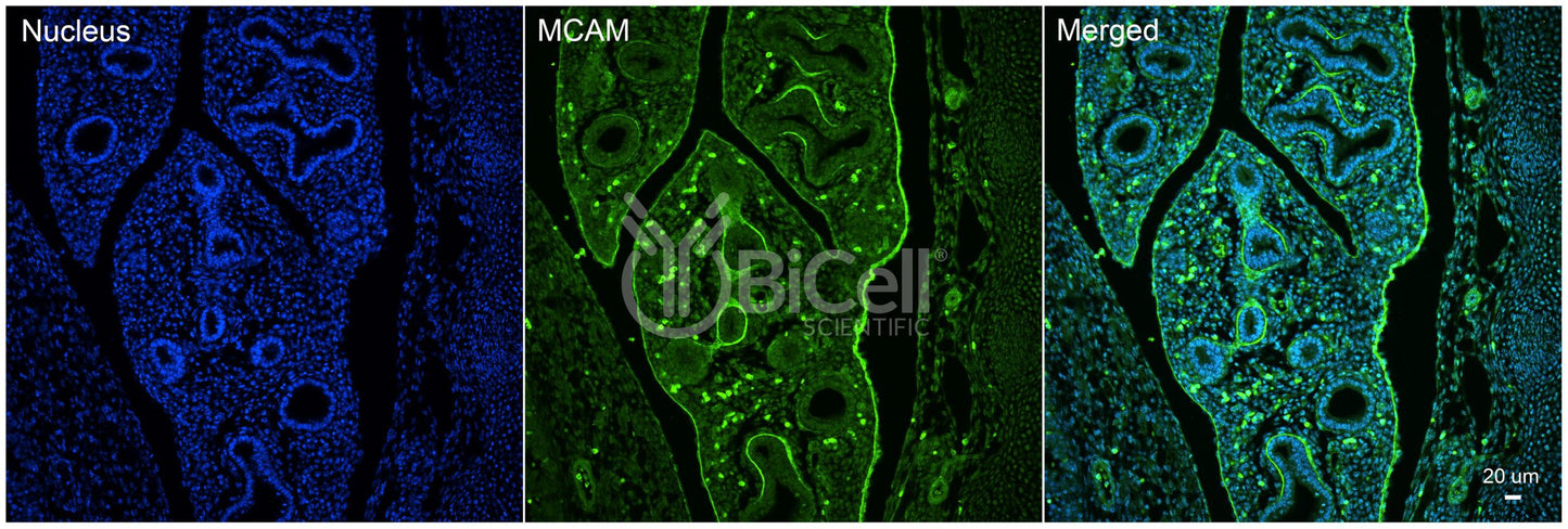 MCAM (CD146 or MUC18) Antibody - FFPE Validated