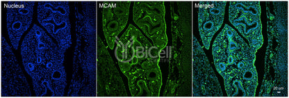 MCAM (CD146 or MUC18) Antibody - FFPE Validated
