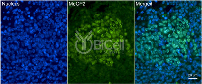 MeCP2 Antibody - Western Blot Validated