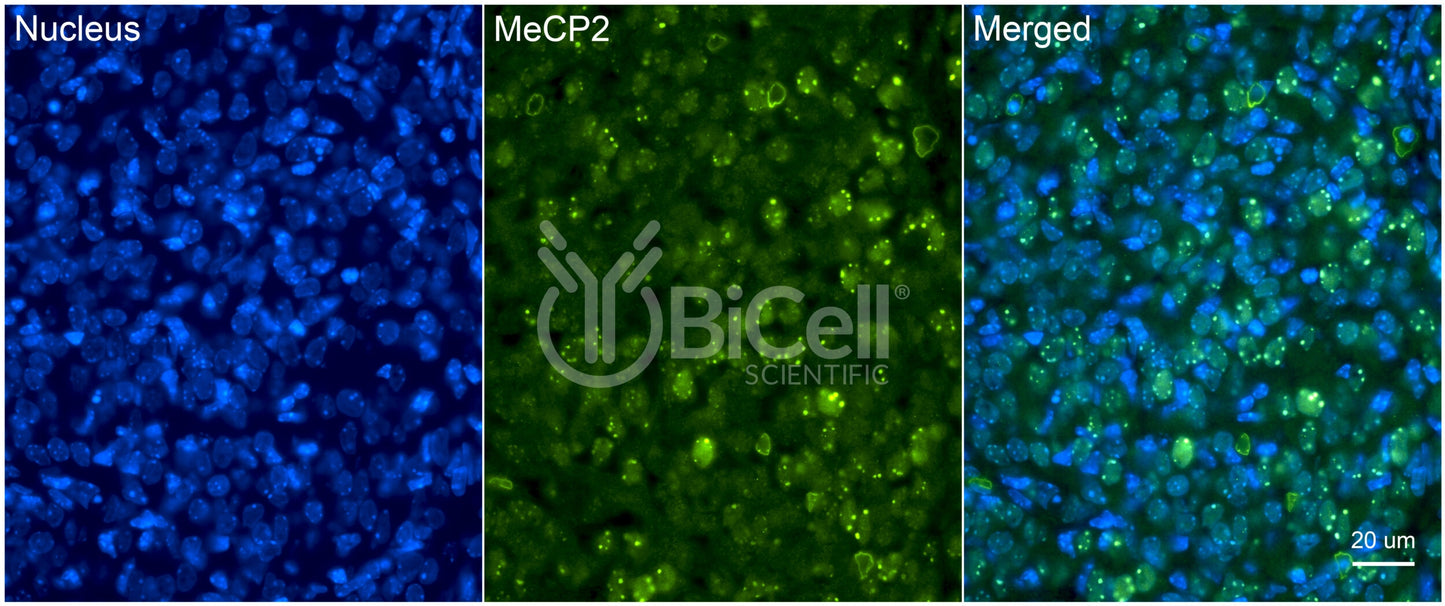 MeCP2 Antibody - FFPE Validated