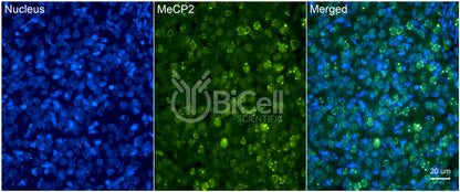 MeCP2 Antibody - FFPE Validated