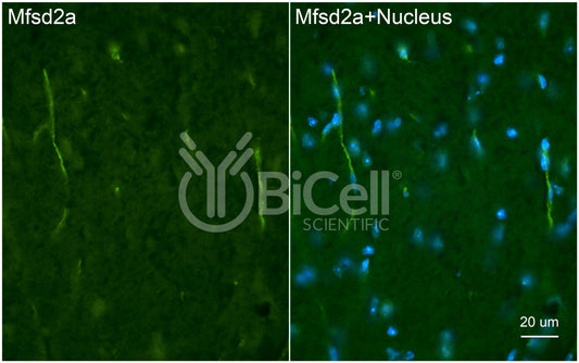 MFSD2A (NLS1) (C-Terminus) (Cytoplasmic) Antibody - FFPE Validated