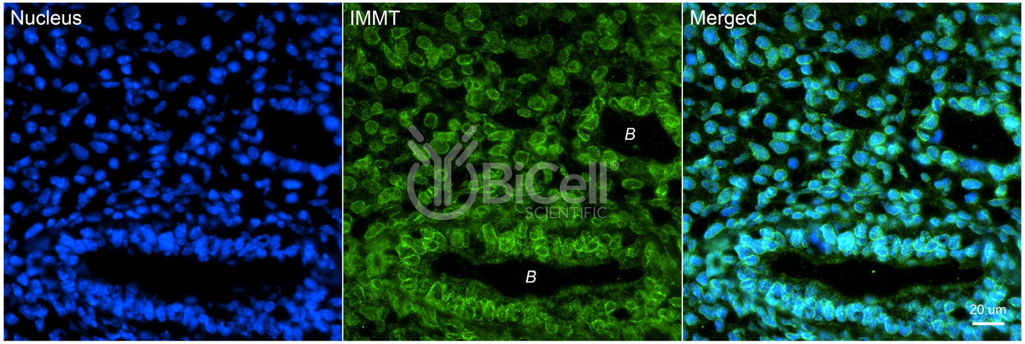 IMMT (Mitofilin or Mic60) Antibody - Western Blot Validated