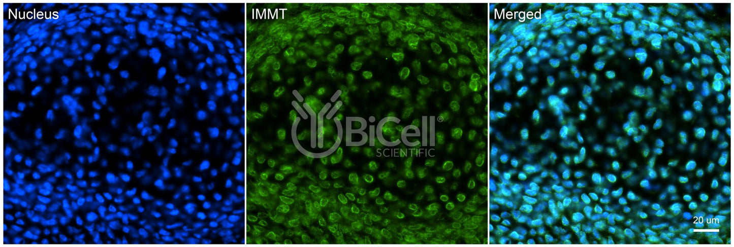 IMMT (Mitofilin or Mic60) Antibody - Western Blot Validated