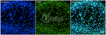 IMMT (Mitofilin or Mic60) Antibody - FFPE Validated