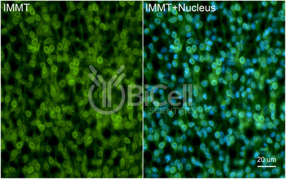 IMMT (Mitofilin or Mic60) Antibody - FFPE Validated