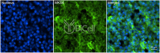 MKS6 (CC2D2A) Antibody - FFPE Validated