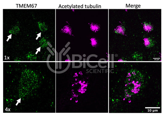 MKS3 (NPHP11 or Meckelin or TMEM67) (Xenopus) Antibody - FFPE Validated