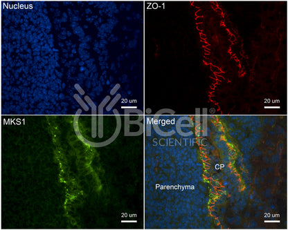 MKS1 (BBS13) Antibody - Western Blot Validated