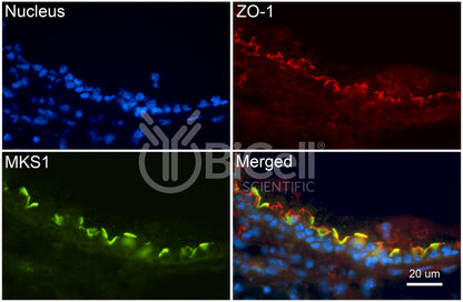 MKS1 (BBS13) Antibody