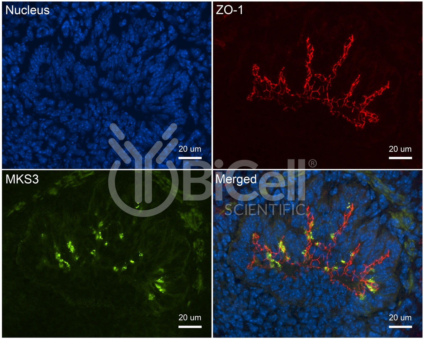 MKS3 (NPHP11 or Meckelin or TMEM67) Antibody