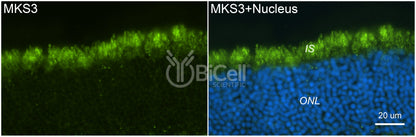 MKS3 (NPHP11 or Meckelin or TMEM67) Antibody - FFPE Validated
