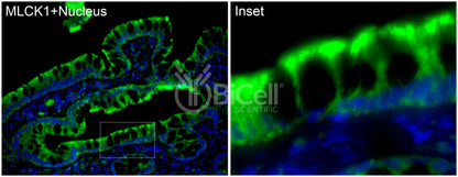 MYLK (MLCK or MLCK1) Antibody - FFPE Validated