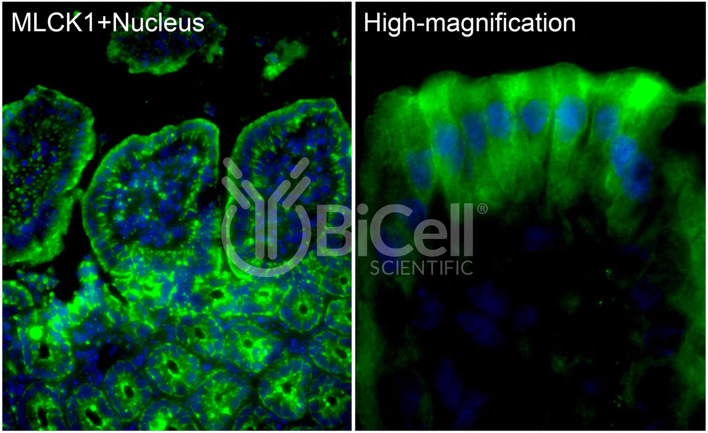 MYLK (MLCK or MLCK1) Antibody - Western Blot Validated
