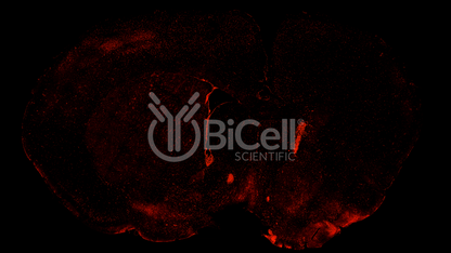 CHRNA2 Antibody - FFPE Validated