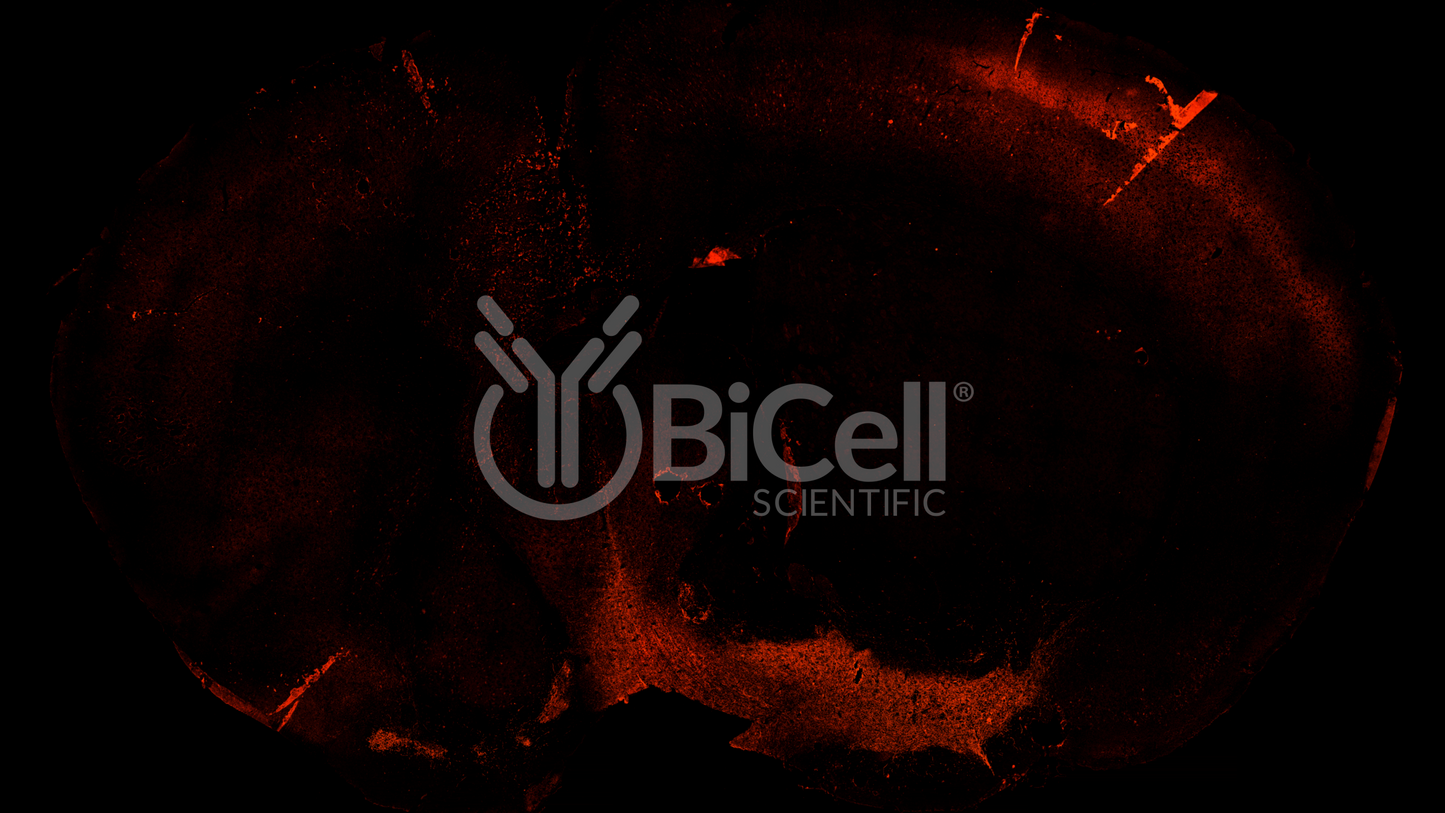 GABRA1 Antibody - FFPE Validated