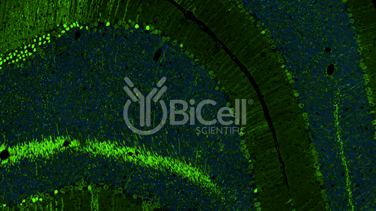 Calbindin-1 (CALB1 or Calbindin D-28K) Antibody - FFPE Validated