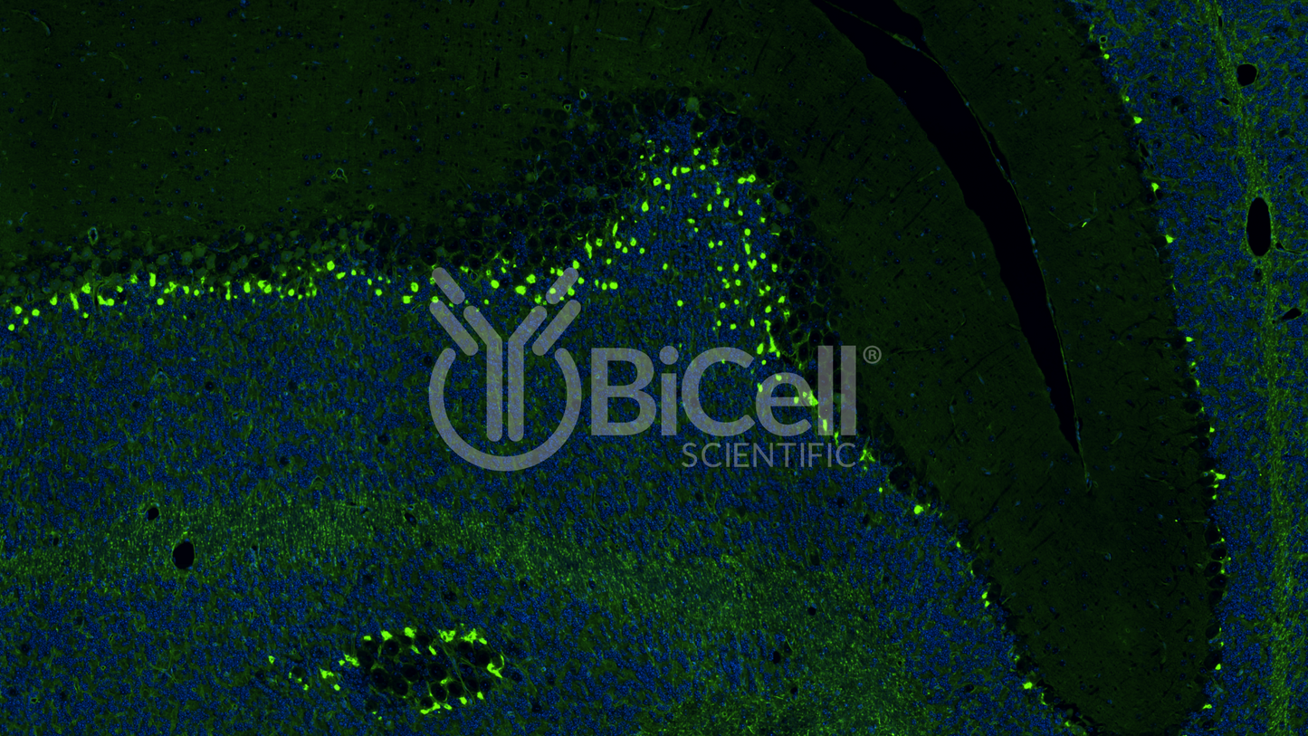 KCNA1 (Kv1.1) Antibody - FFPE Validated