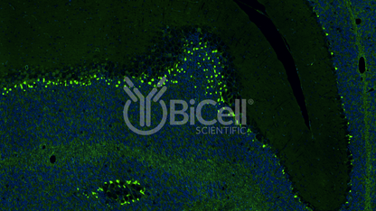 KCNA1 (Kv1.1) Antibody - FFPE Validated
