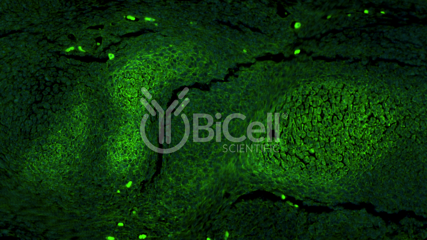 AKT (AKT1 or RAC or PKB) Antibody - FFPE Validated