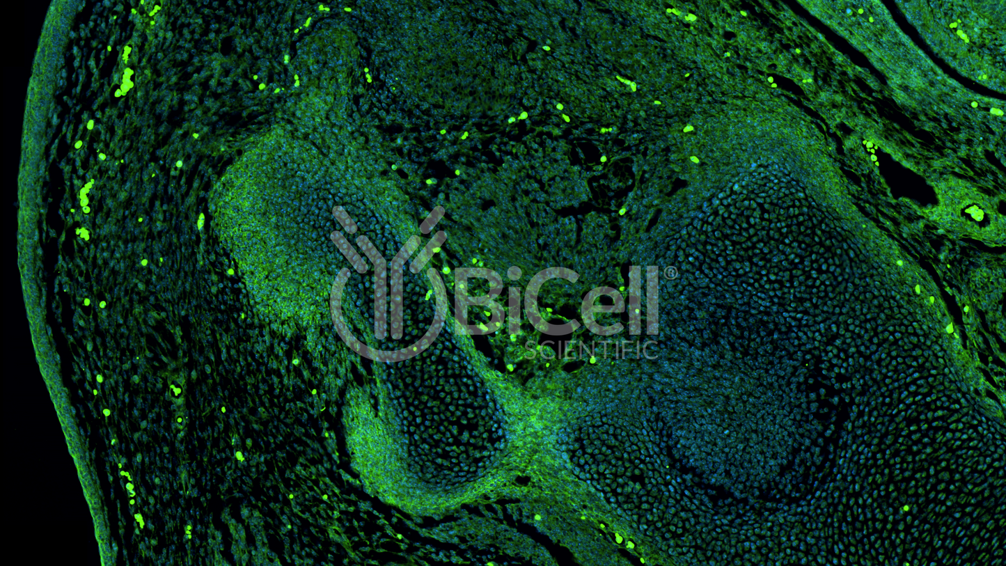 EGFR (ErbB1 or HER1) Antibody - FFPE Validated