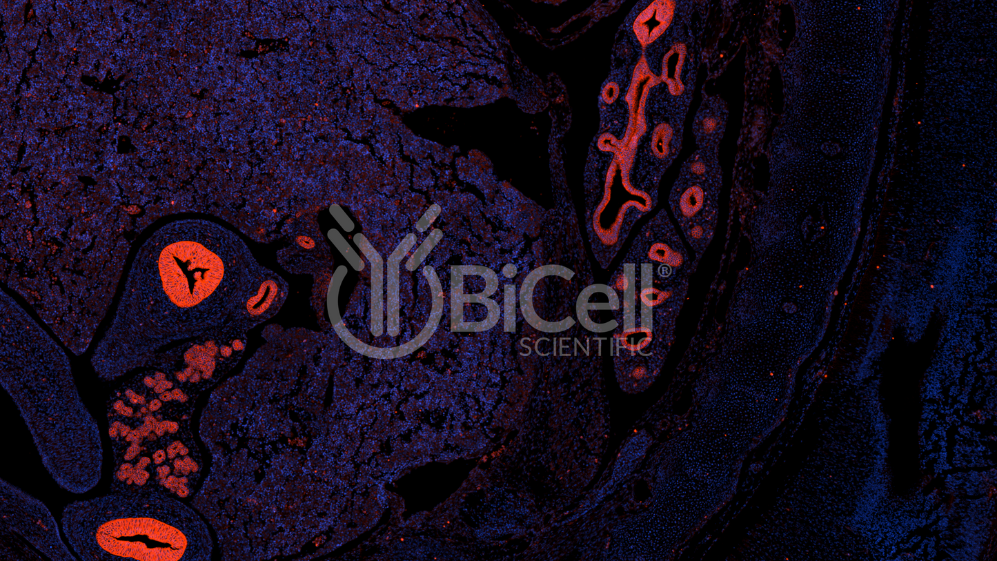 EpCAM (CD326 or 17-1A antigen or TACSTD1) Antibody - FFPE Validated