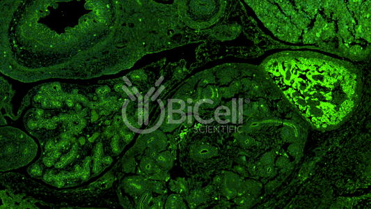 FAT1 Antibody - Western Blot Validated