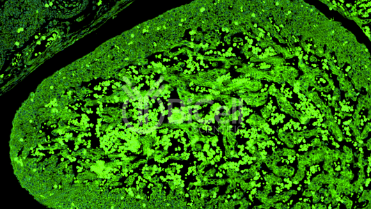 Syncoilin (SYNC) Antibody - Western Blot Validated