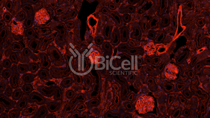 Actinin alpha-4 (ACTN4) Antibody - Western Blot Validated