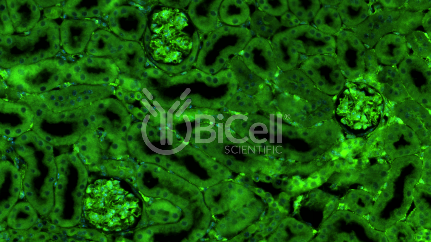 ARHGDIA (GDIA1 or NPHS8) Antibody